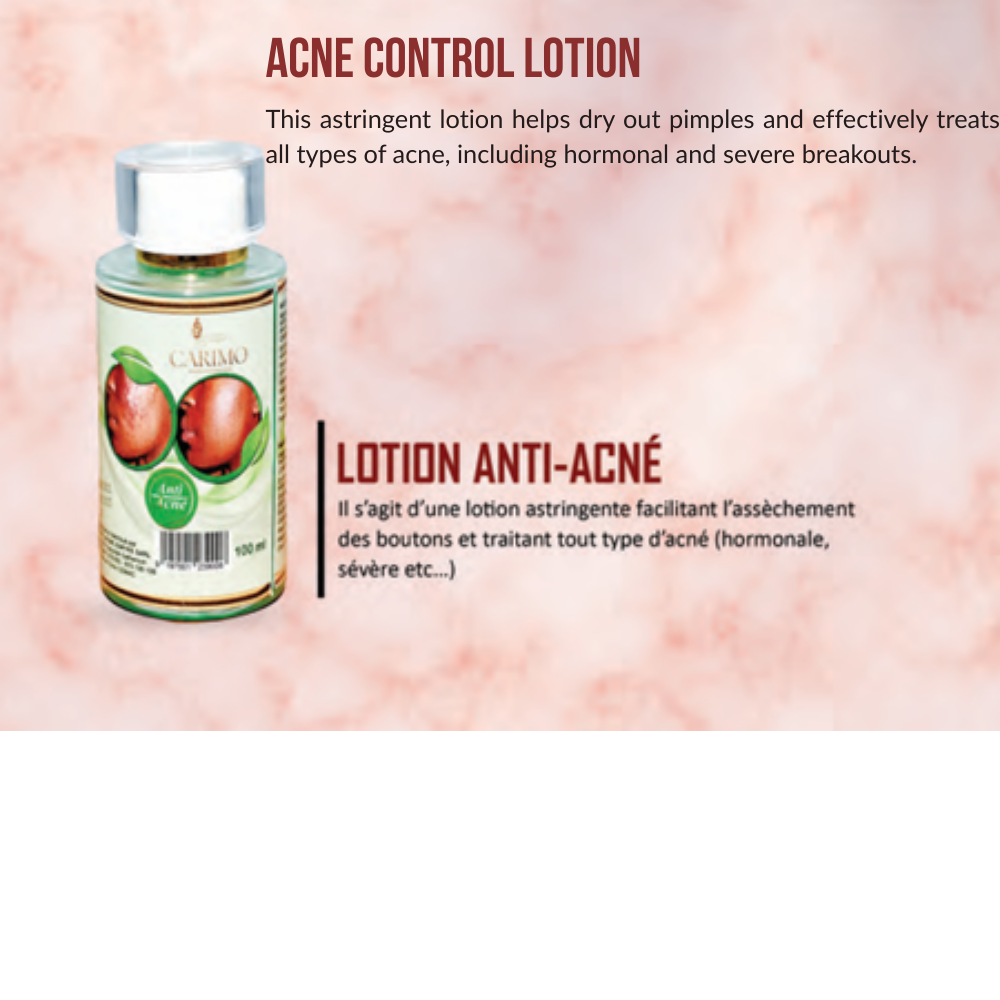 Carimo Acne Control Lotion product image with bilingual English and French text on a soft pink background.
