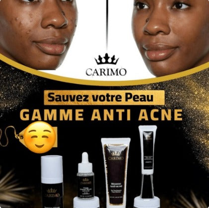 Advertisement for Carimo anti-acne skincare products with before and after  faces and product bottles.