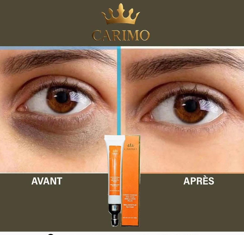 Before and after comparison of eye with dark circle with Carimo correcting dark circle cream product in the middle.