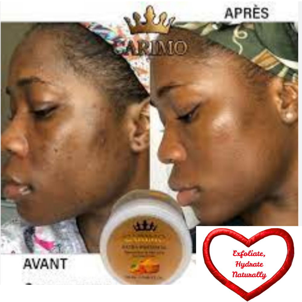 Before and after comparison of a product's effect on skin with 'Carimo' branding.