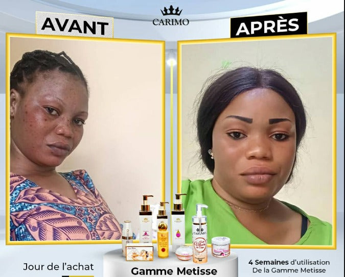 Before and after comparison of a woman's face with carimo metiss cosmetic products labeled 'Avant' and 'Apres'.