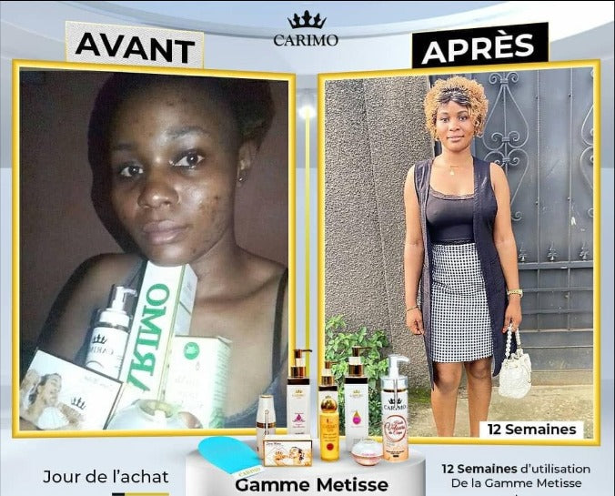 Before and after comparison of a woman using Carimo Metisse skincare products, showing visible changes over 12 weeks.