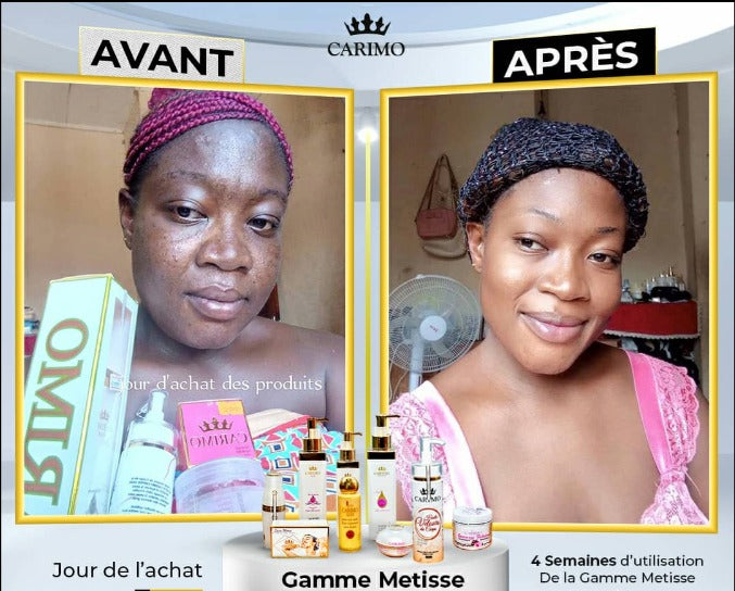 Before and after comparison of a woman using Carimo Metisse skincare products.