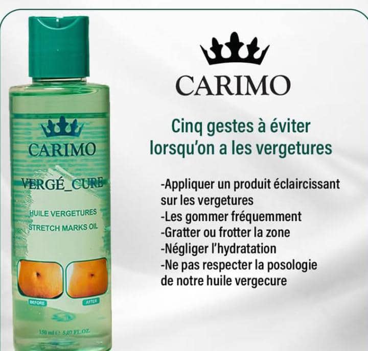Carimo stretch marks oil bottle with instructions on a white background