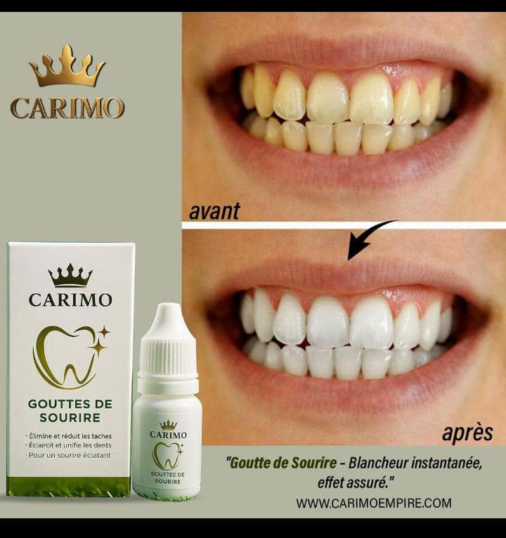 Carimo teeth whitening product before and after usage on a person's teeth.