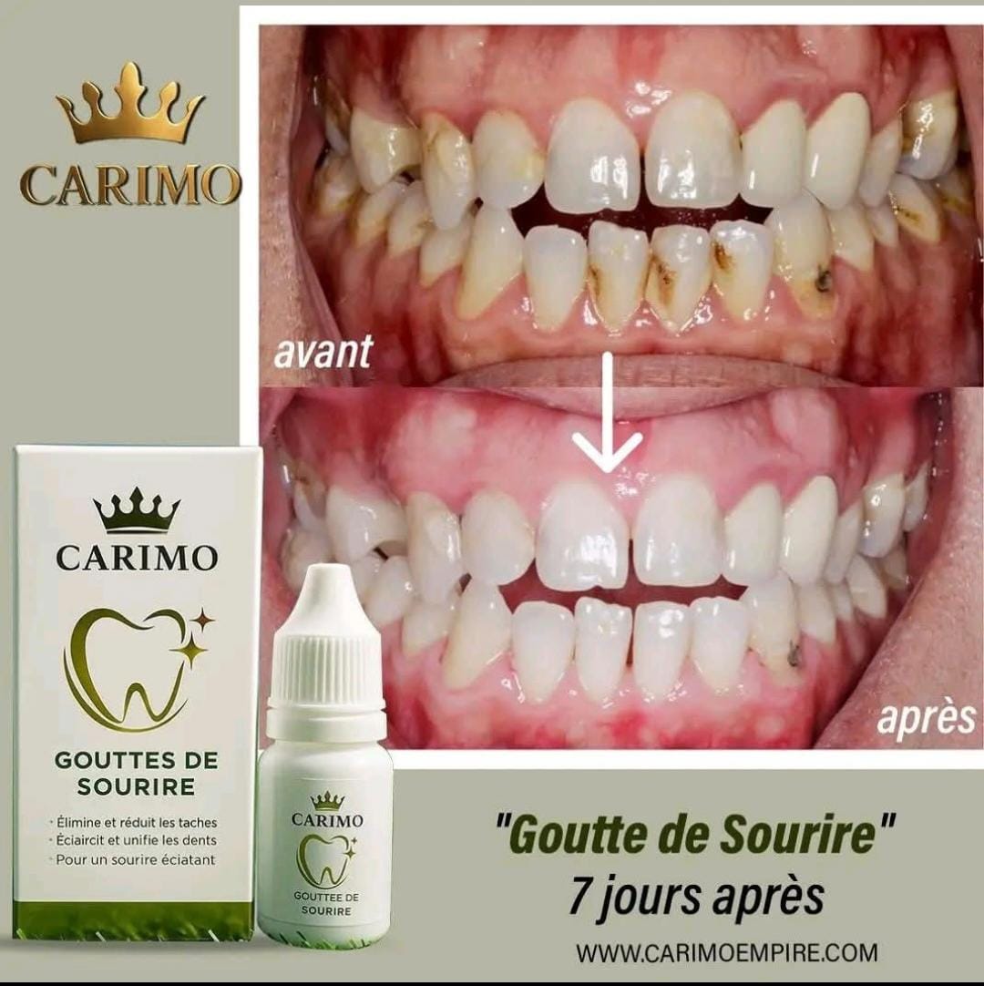 Carimo dental product packaging with before and after dental images showing teeth whitening results.
