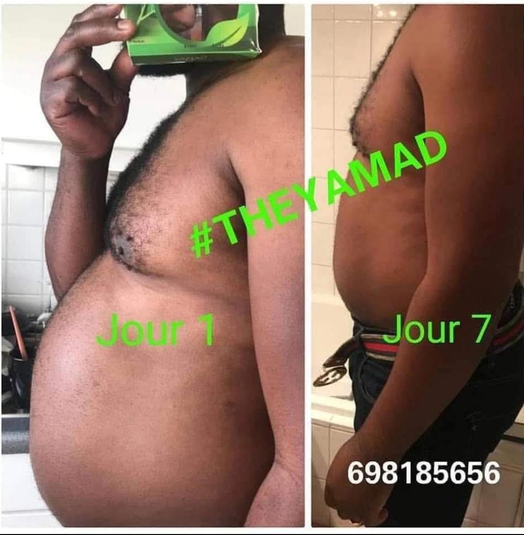 YAMAD Slimming Tea – Day & Night Formula - Duo Yamad