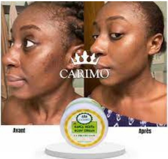 Before and after comparison of a woman's face with Carimo Kayla gluta glow cream displayed.
